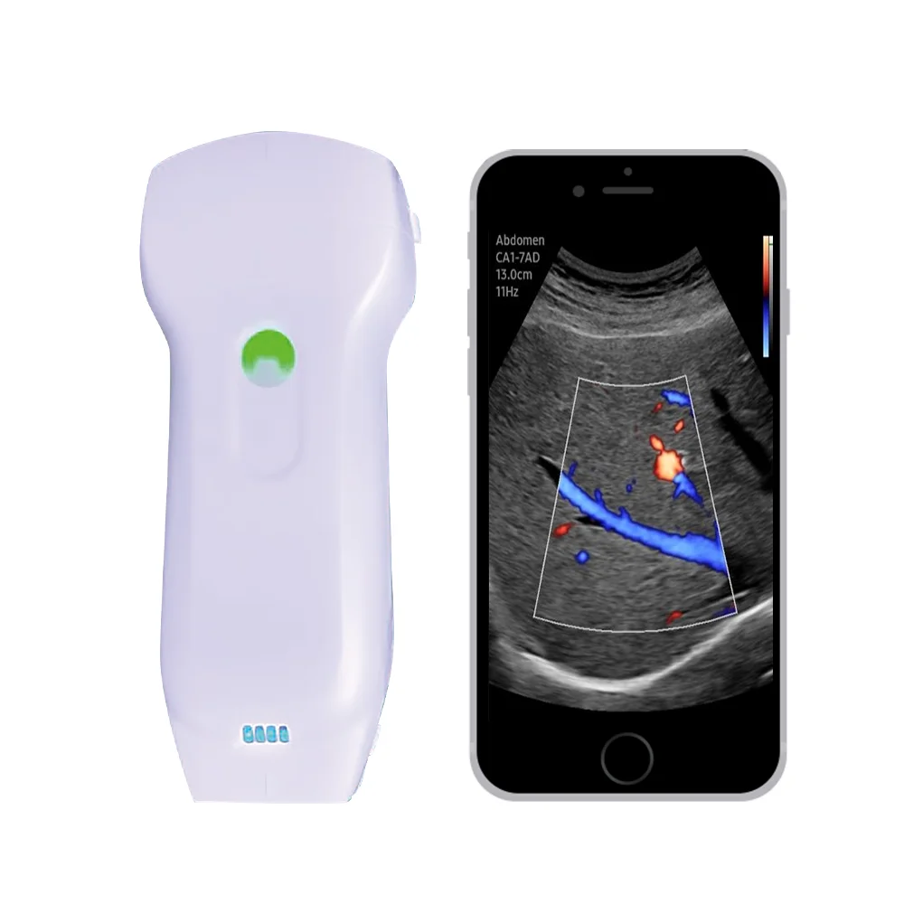 medical supplies Wireless Ultrasound Scanner Probe 3 In 1 Mini Wifi Color Doppler Pocket Ultrasound Liner Convex