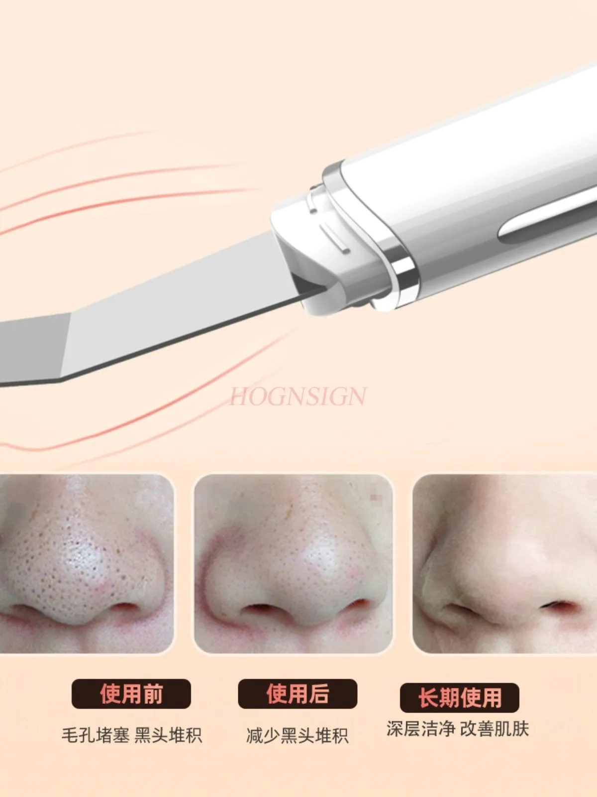 超音波洗顔料美容器ニキビ除去黒ずみシャベル毛穴クリーナーピーリングマシン