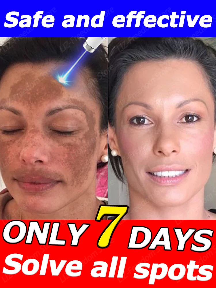 

Highly effective facial repair dark spot freckle