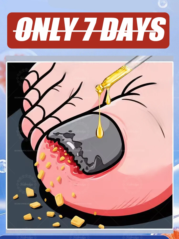 2025年、真菌を迅速に除去し、健康な爪を取り戻します