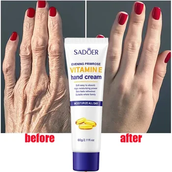 Vitamine E Handcrème Hydraterende Anti Cracking Voedende Anti-uitdrogen Rimpel Verwijderen Hand Huidverzorging Gebarsten Reparatie Cosmetica