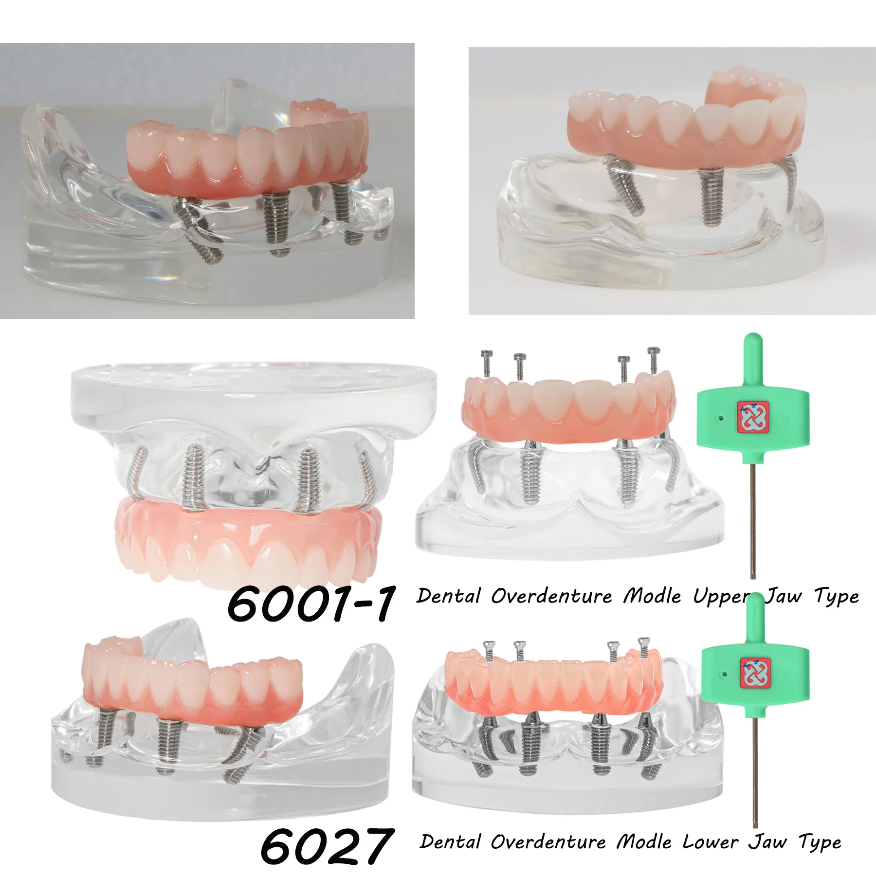 

Dental Implant Teeth Model Transparent Upper/Lower Jaw Type All on 4 Overdenture Modle M6001-1 M6027