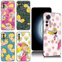 Hey Arnolds Cartoon Case For Xiaomi Redmi K40 K50 Gaming Note 6 7 K20 K60 Pro 7A 8A 9A 9C 9i 9T 10A 10C 12C A1 A2 Plus Cover