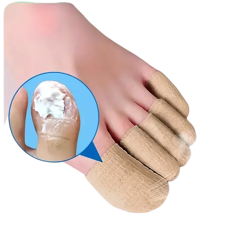 발톱 곰팡이 치료, 발톱 붕대 수리, 발톱 치료, 발톱 치료, 곰팡이, 에센셜 오일, 손톱