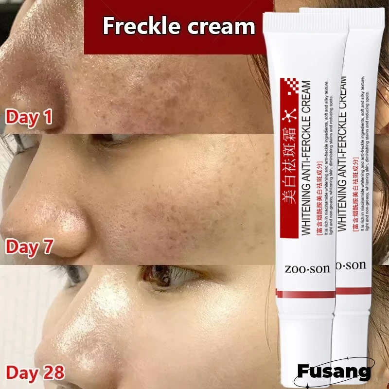 

Face Melasma Cream Brighten Dark Skin Emulsion Lightening Melanin Brighten Cream for Dull Skin Women Moisturizing Skin Care