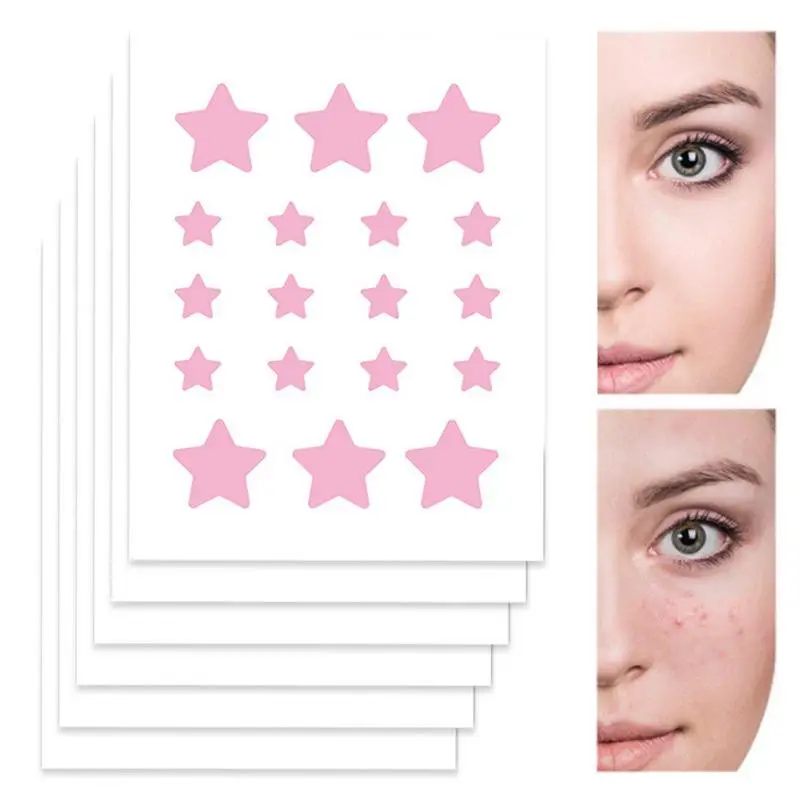 

108 Pcs Acnes Patches Invisible Pimple Spot Patches Hydrocolloid Acnes Spot Pimple Patches Effective Pimples Sticker For Zit