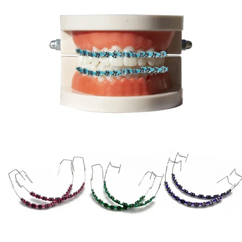 1 Stück Hosenträger Dekoration Kette Dental Kieferorthopädische Temporäre Zubehör Hosenträger Box Oral Hosenträger Mode Dekoration