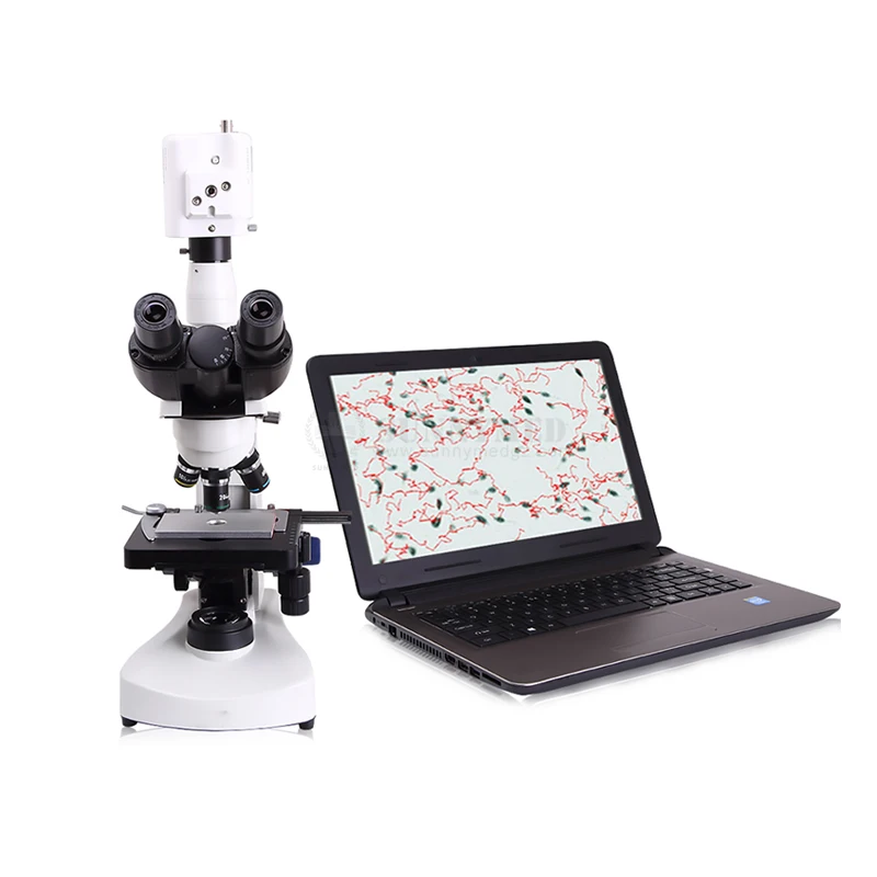 SY-B178V Full-automatic Veterinary Sperm Analysis Quality Analyzer Kit