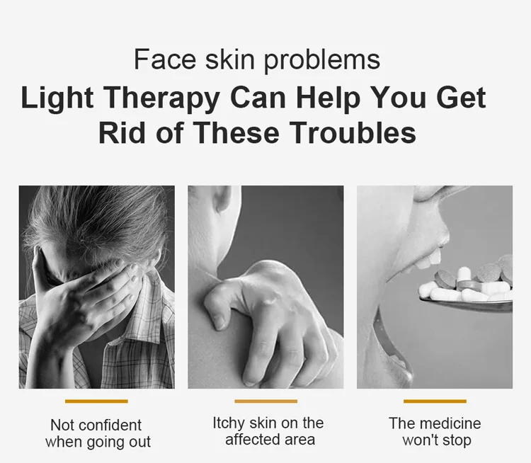 Lampu Uvb Lampu Uv Fototerapi Terapi Cahaya Psoriasis 311nm Terapi Cahaya Uvb Krim Perawatan Vitiligo