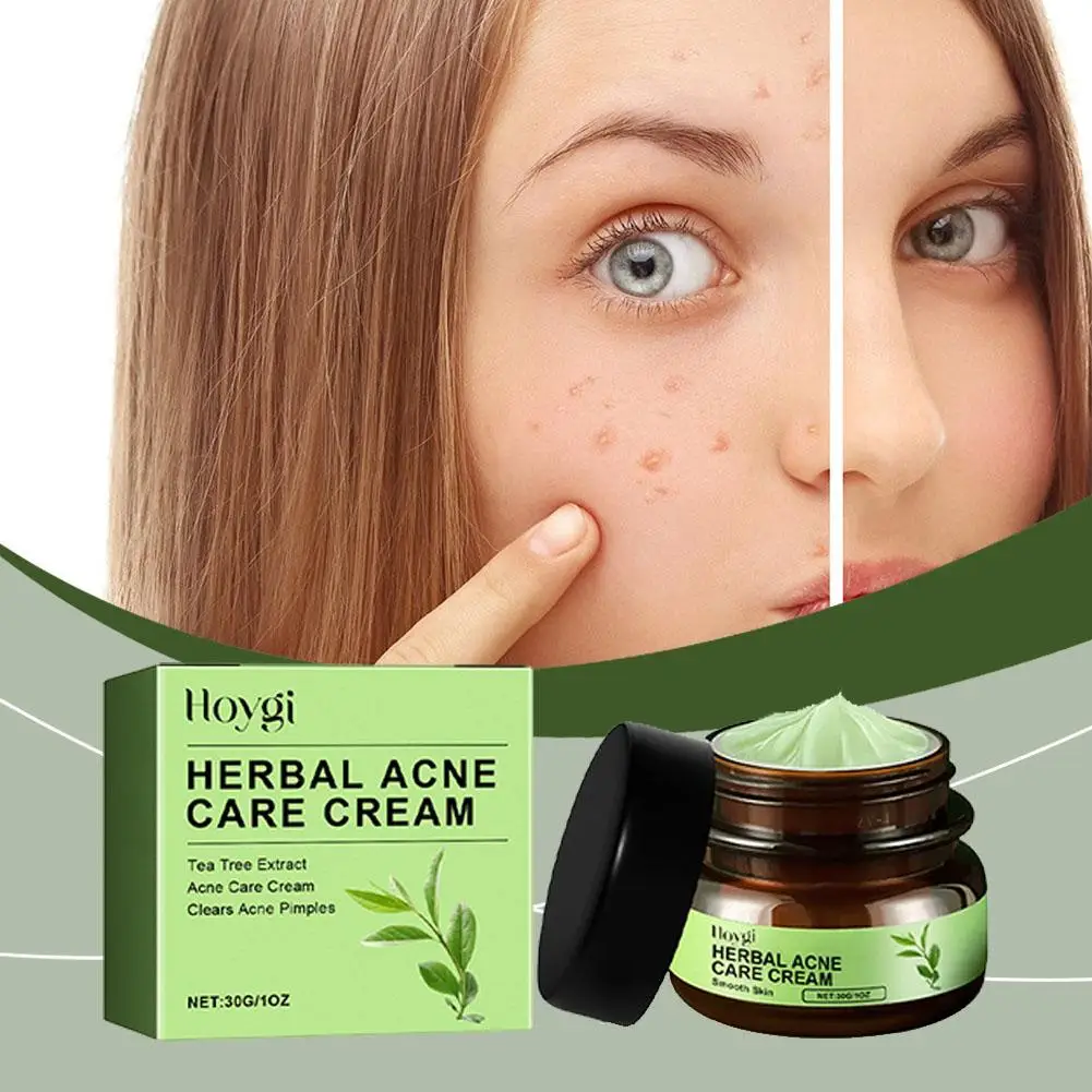 Herbal Acne Cream Shrink Pores Refining Cream Oil Control Blackhead Moisturizing Care Remover Nourishing Skin Korean Produc B8U8