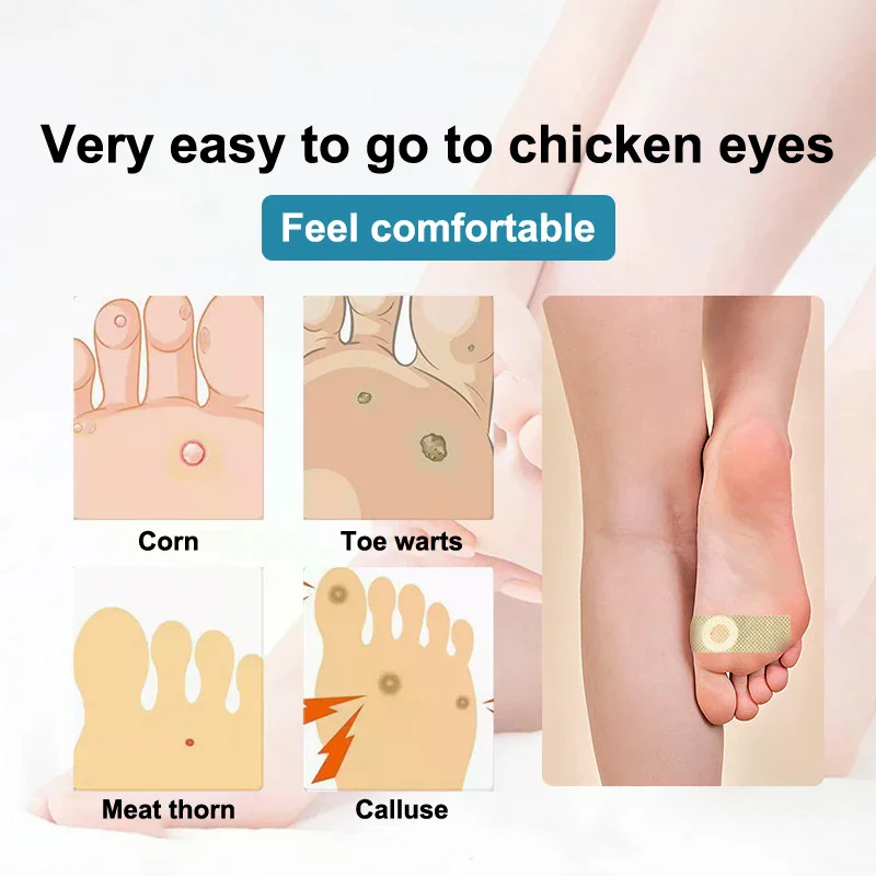 6-12-18-24-30-36-шт-пластыри-для-удаления-мозолей-и-натоптышей-подушечки-для-ног-аксессуары-для-обуви-средства-по-уходу-за-ногами