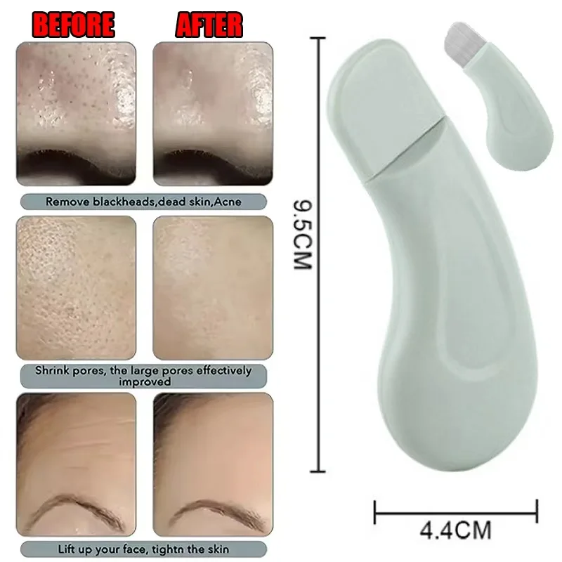1/2/3pcs Deep Cleansing Blackhead and Whitehead Removal Tool for Nose and Face - Skin Pore Cleaner Skin Care Tools for Women