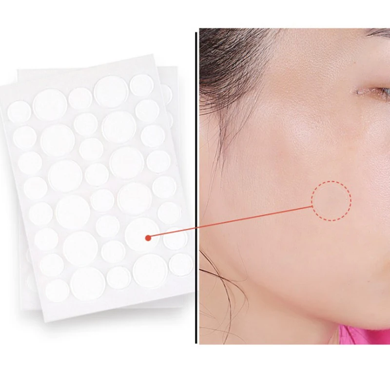 Acne Pimple Patch Stickers Pimple Remover Tool Absorb Pus And Oil Acne Patch