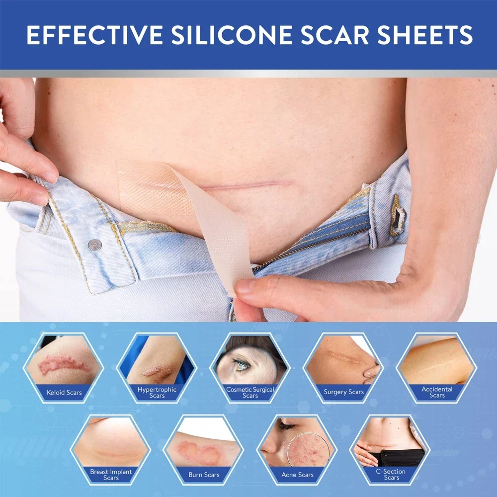 1 Roll Silicone Scar Sheets, Soft Gel Tape,Flexible for Surgery,Keloids,Burns,Sensitive Skin,Wound Protection,Healing Patch