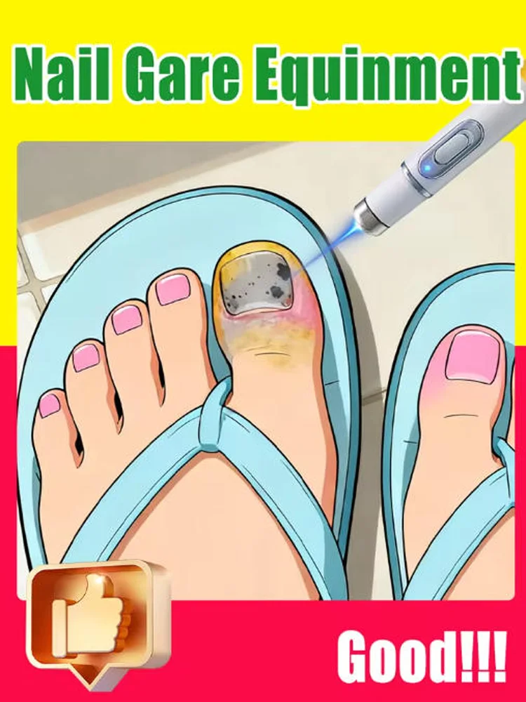 

Горячие продажи 2025: инструменты для чистки ногтей, лазерные инструменты с синим светом, ремонт корней, модернизированные второе поколение