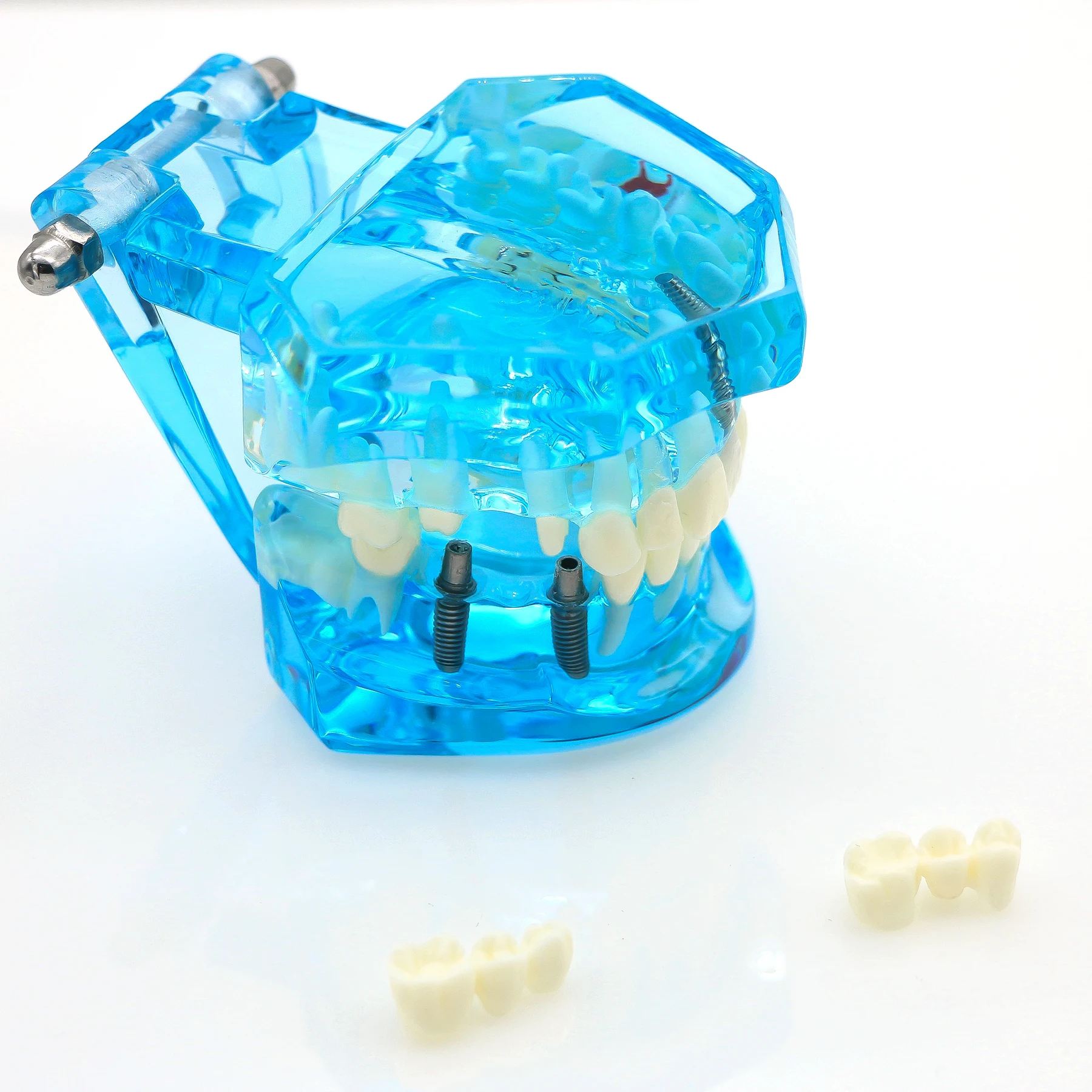 نموذج ترميم زرع الأسنان نموذج لتدريس طبيب الأسنان دراسة طب الأسنان منتجات طب الأسنان المعيار الأزرق 1:1 #5