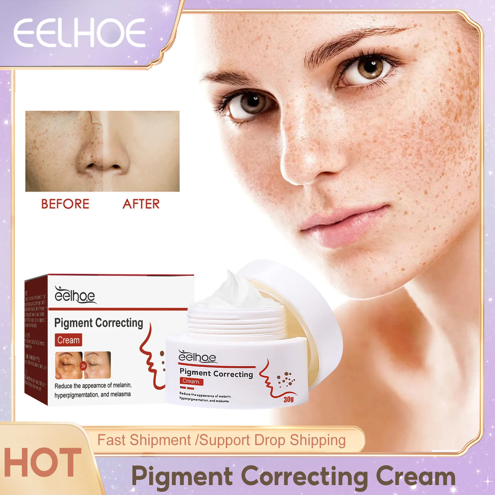 Pigment Brighten Face Cream Remove Dark Spot Correcting Melasma Melanin Whitening Freckle Improve Dullness Niacinamide Skin Care