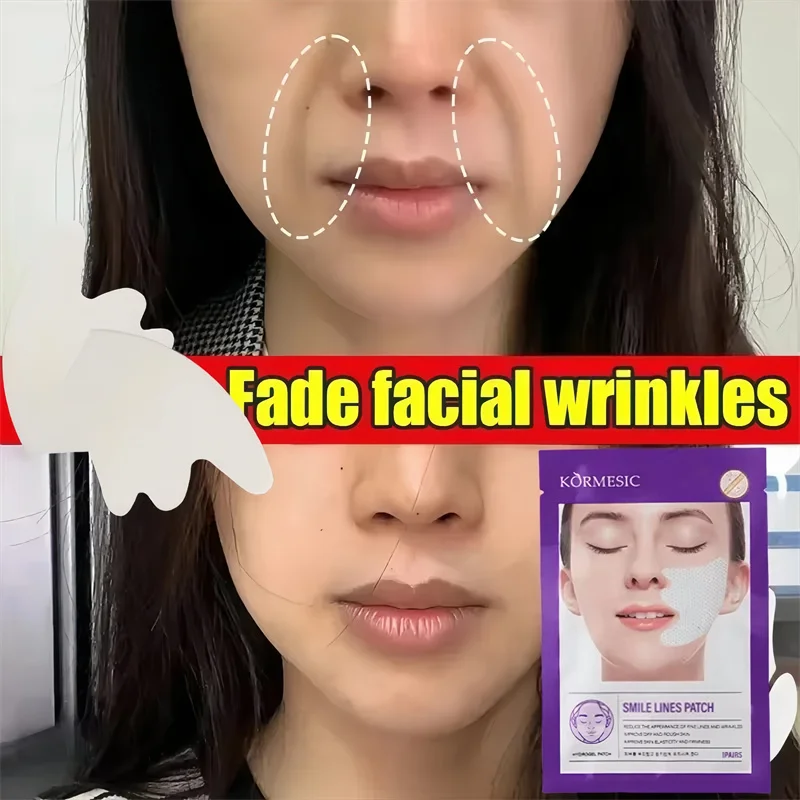 

Nasolabial Folds Patch Contain Collagen Hyaluronic Acid Firming Skin Fade Fine Lines Deep Moisturizing Facial Mask Anti Wrinkle