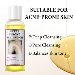 Yellow Peeling Oil Lightening Exfoliating Dark Skin Body Strong Peeling Oil For Skin Brightening Moisturizing