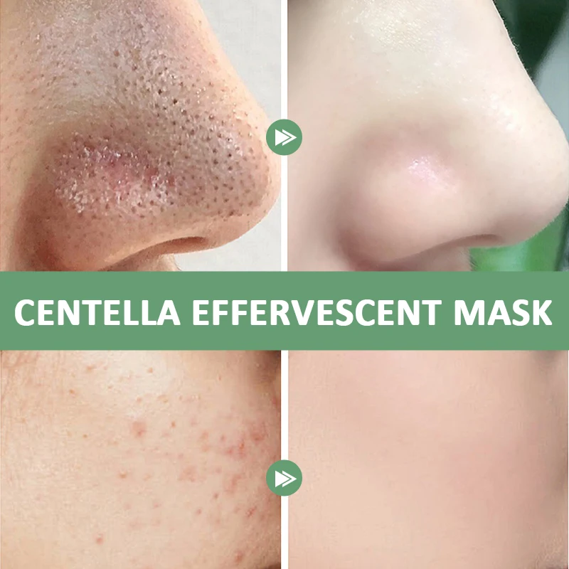 120g Deep Cleansing Moisturize Centella Facial Clay Bubble Mask Blackhead Pore Clean Oil Control Smooth Repair Facial Care