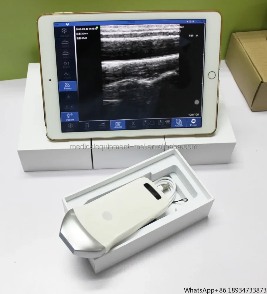 New coming Wireless linear probe / wireless convex probe ultrasound machine MSLPU35/41/42