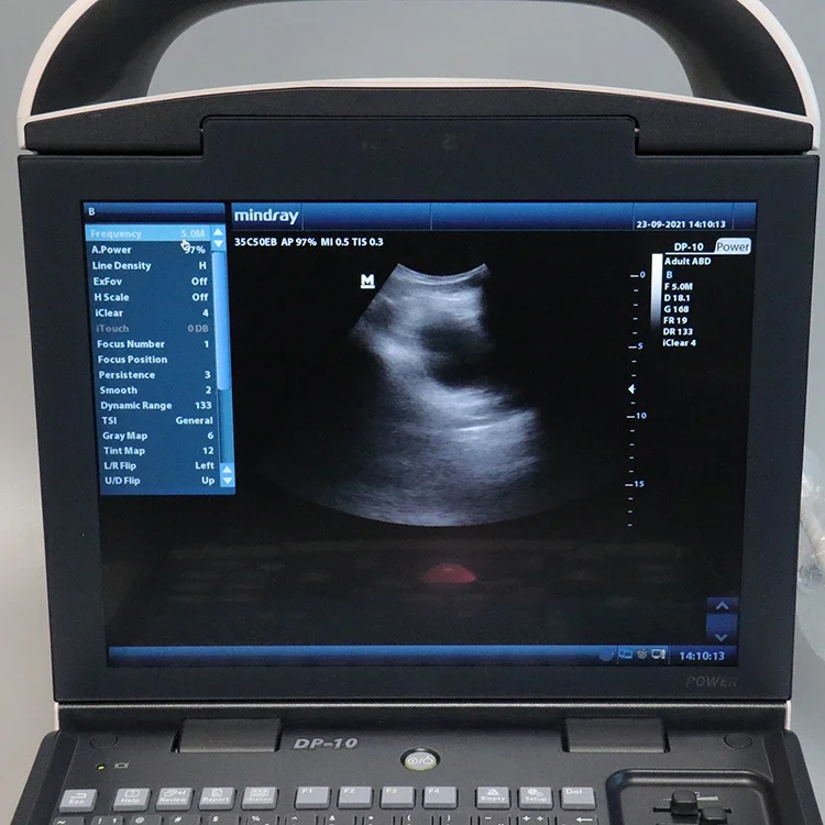 Mindray Portable Medical Ultrasonido Sonografo Portatil Ecografo Mindray Dp 10 Ultrasound Machine
