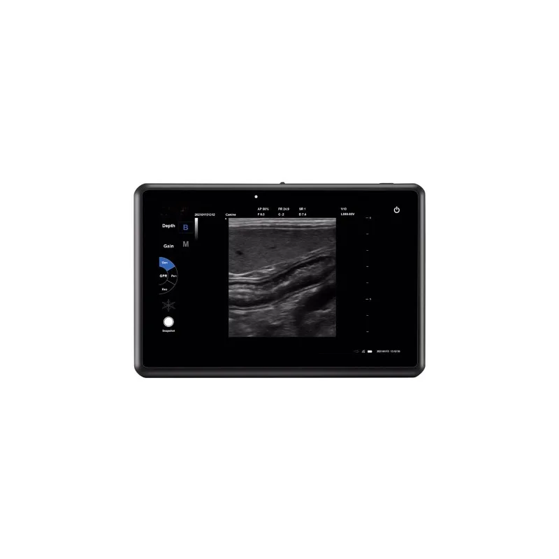 2026 Veterinary Ultrasound Scanner a Sheep Horse Pig Farm Rectal Ultrasound Animal Care and Supplies