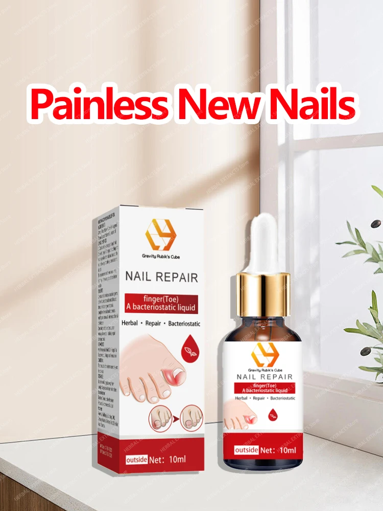 

Solve all nails problems