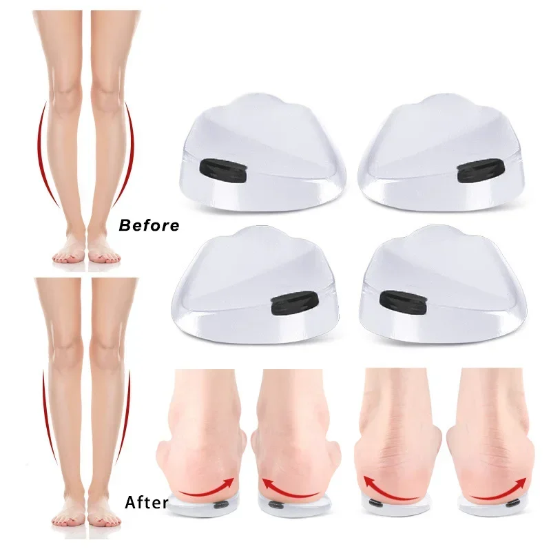 Orthopädische Gel-Einlegesohlen mit Magnetmassage zur Fußpflege, Silikon O/X-Bein-Korrektur für Plantarfasziitis, Schuheinlagen