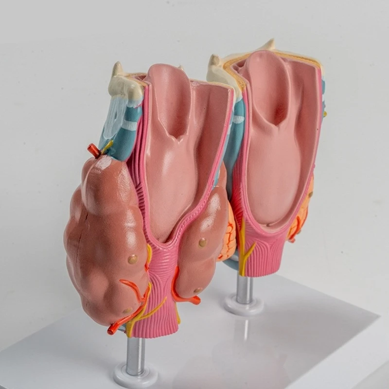Учебное пособие для модели патологической анатомии щитовидной железы человека, анатомическая патологическая модель горла железы