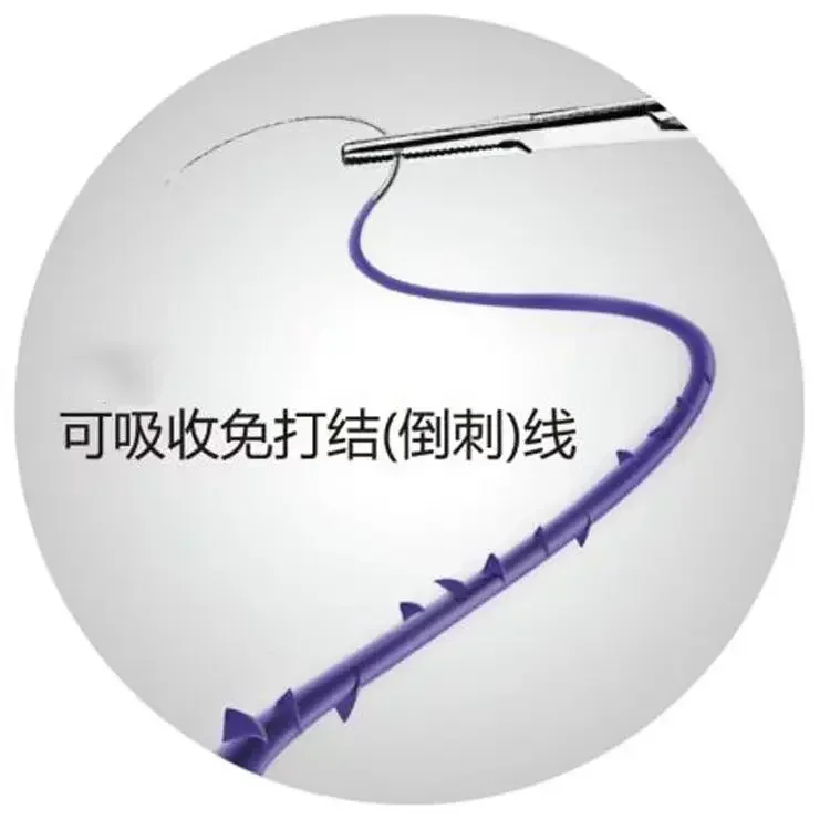 Medical surgery absorbable Barbed thread sutures PDO fish bone thread Disposable Barbed Suture