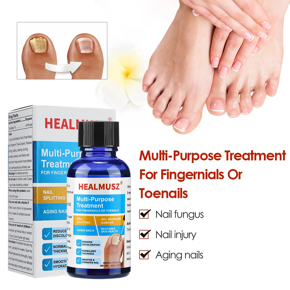 30ml เท้าเล็บเชื้อรา Treatment Toenail Repair Essence Serum Liquid ฟุต Toes Care เครื่องมือเชื้อรา Removal