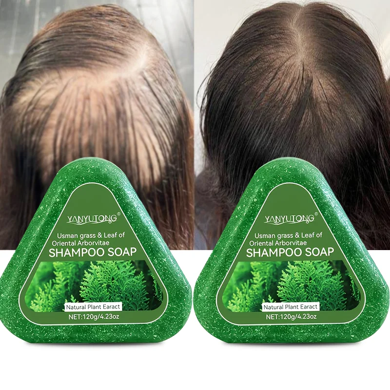 Thumbnail 2 - #14 Best Bar Soaps to Buy In 2026