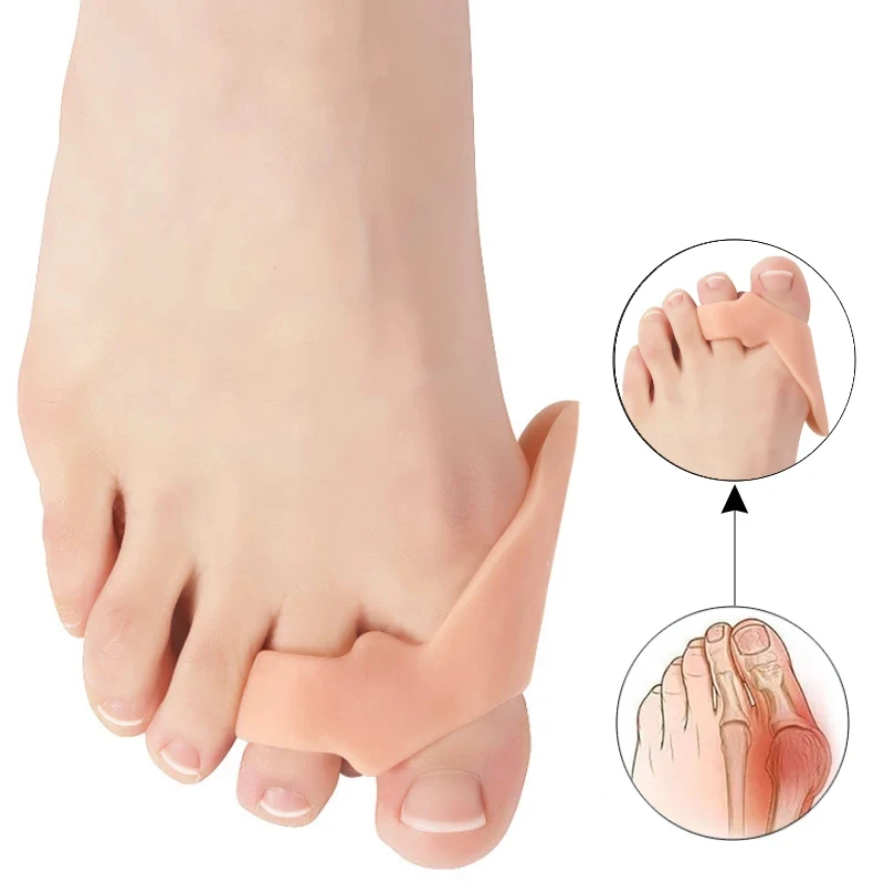 Silicone Gel Toe Separadores, Thumb Joanete Corrector, Maca Pé Dor, Hallux Valgus Correção, Guarda Pedicure, Ortopédica, 2 Pares