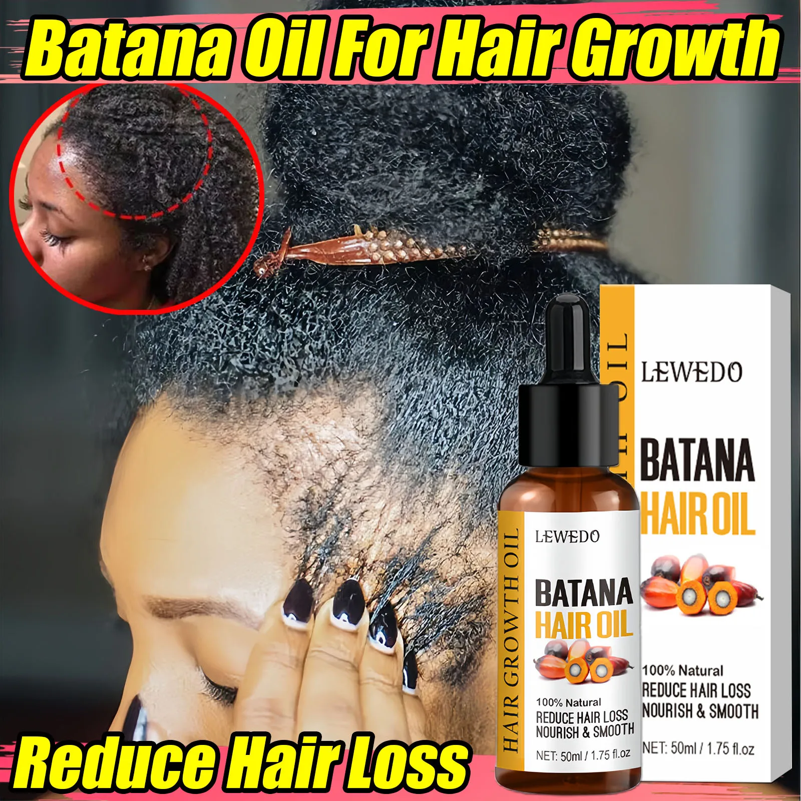 

Batana Oil Hair Growth Products Fast Growth Batana Essence Oil Traction Alopecia Anti Hair Loss Baldness Treatment For Men Women