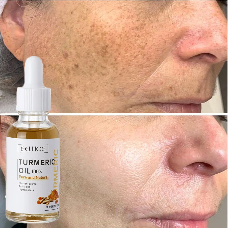 Turmeric Oil Essence That Removes Dark Spots Reduces Fine Lines Acne Moisturize Brightening Anti-aging Anti-wrinkle Facial Serum