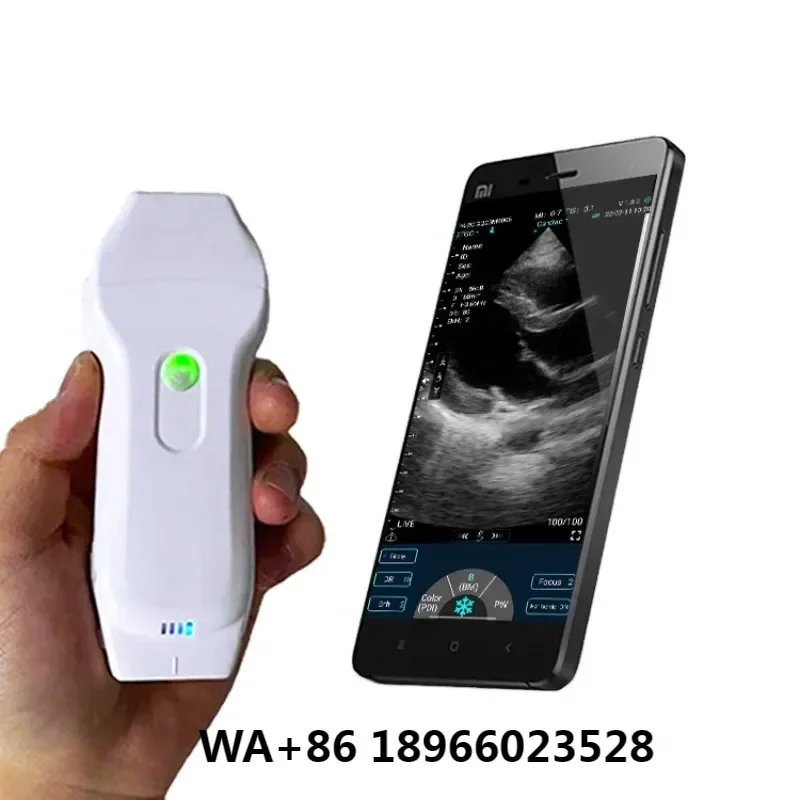 Full Digital LED Professional Double Head Wireless Ultrasound Probe Portable Doppler  Linear Wireless Ultrasound Scanner