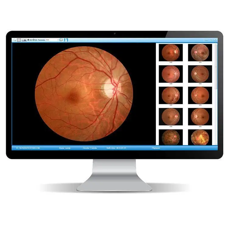 Hot Selling AIST SK-650A Digital Retinal Camera Price Popular Model SK-650A Nonmydriatic Fundus Camera