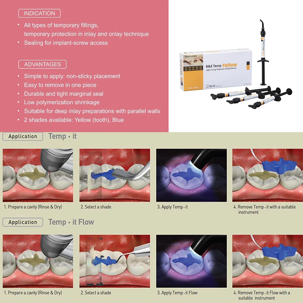 Dental Supplies Flowable Temporary Filling Material Restorative Temp It Flow Light Cure implant Abutment Screw Sealing Products