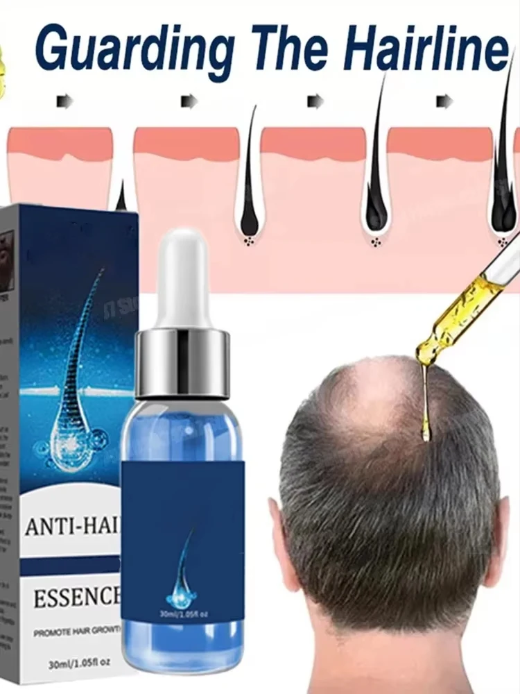 Fast Hair Growth Essential oil Promoter Hair Loss Hereditary Seborrheic Alopecia For aHair Growth Essence