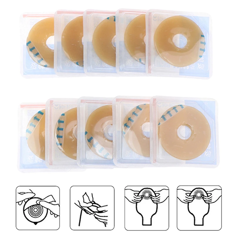 Ostomy Paste Ring Baseplates Stoma Care Leak-Proof Ring For Ostomy Bag Stretch Shaping To Prevent Leakage Protect