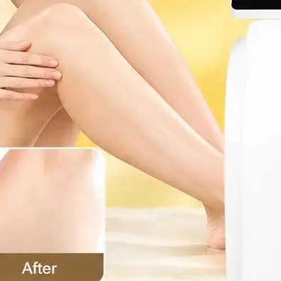 Professional Ice Titanium Diode Laser Hair Removal 808 755 1064nm Alexandrite 3 Wavelength Portable Painless Permanent Machine