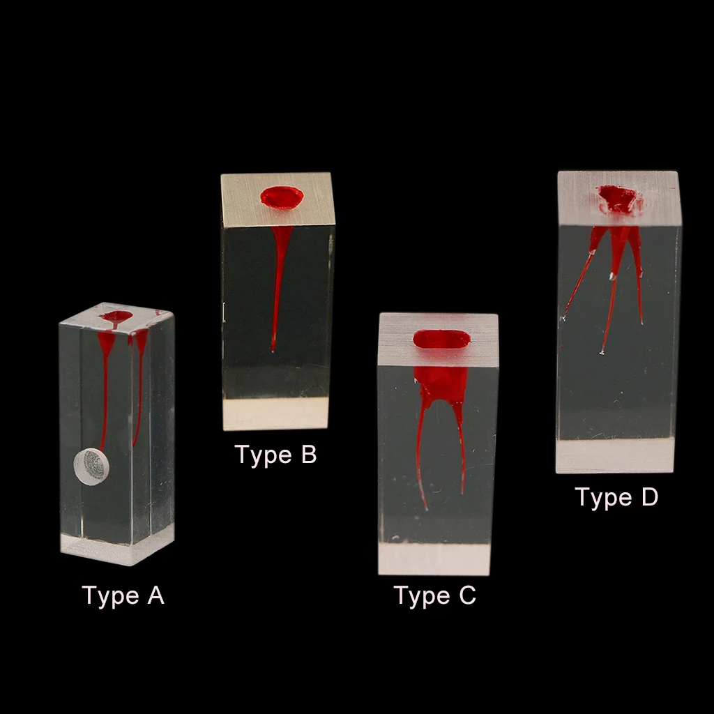 Modelo de enseñanza de bloques de Canal de raíz Dental, entrenamiento de endodoncia, modelo de dientes, práctica RCT, cavidad de pulpa, resina,