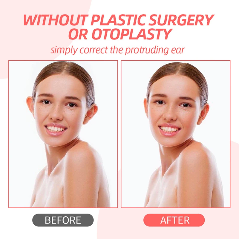 

2/4/6/8 шт., корректирующая лента для ушей, фиксатор коррекции ушей, косметические наклейки для ушей, как уши эльфа, растянутые уши, инструмент для коррекции ушей