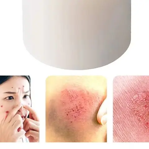 

Гидроколлоидный рулон для ухода за ранами Гидроколлоидные пластыри с самоклеящимися клеями, бинты от боли в кровати, очень впитывающие для ожогов