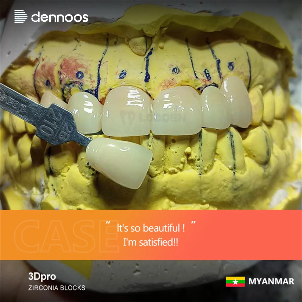 LODDEN 3D Pro Zirconia Blocks Multilayer Blocks 98mm Translucence Cad Cam System Dental Lab Materia