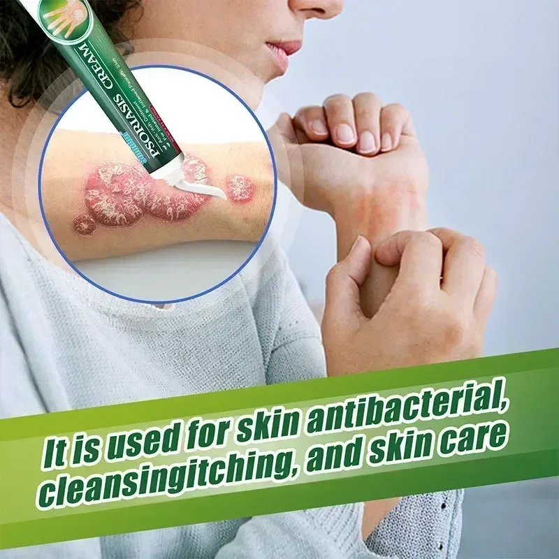 Herbal Psoriasis Treatment Cream Antibacterial Anti-itch Dermatiti Eczema Urticaria Alergy Skin Ointment Beauty Health Body Care