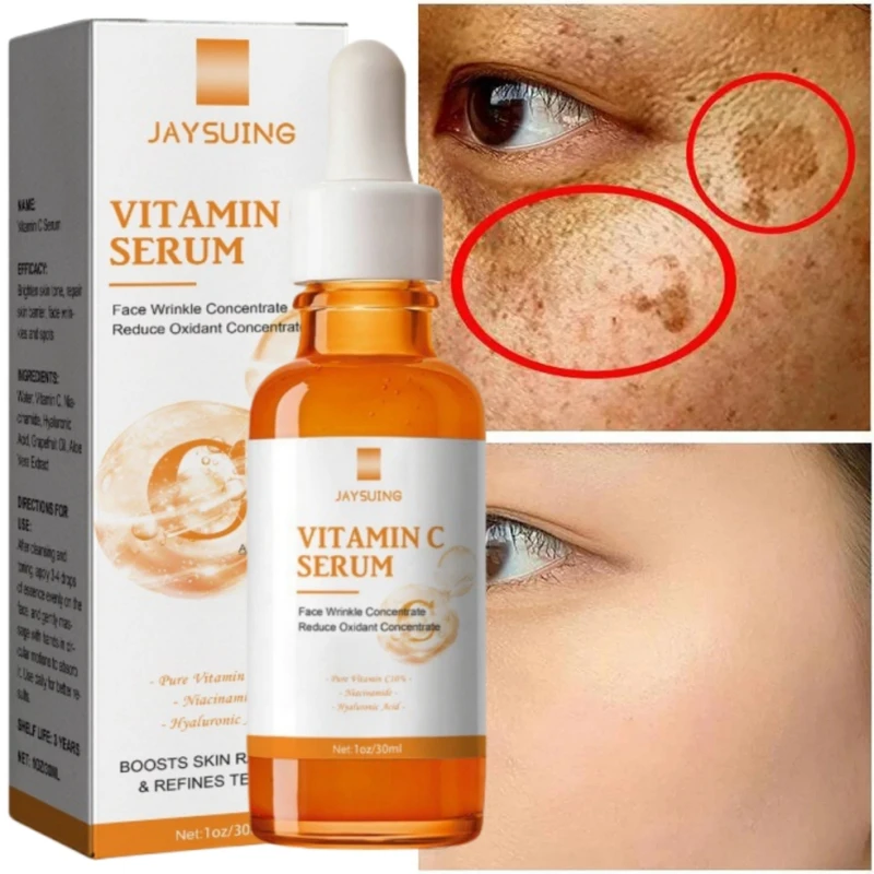 Vitamine C Whitening Serum Gezicht Verwijderen Donkere Vlekken Sproet Melasma Fade Skin Melanine Retinol Anti Aging Essence Fleuren Huidverzorging