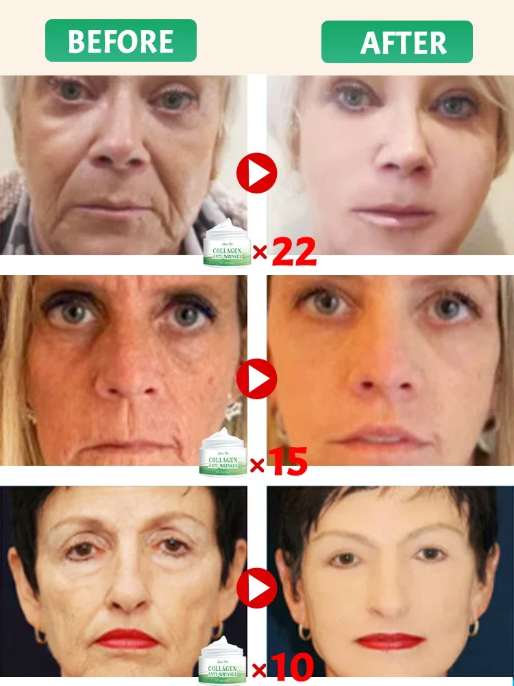 Wrinkles disappear in 7 days