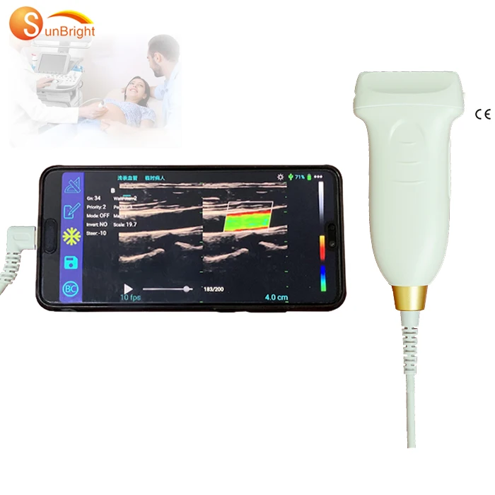 color doppler USB probe SUN-D2 ultrasound for phone